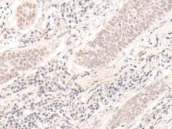 ZBED1 / TRAMP Antibody