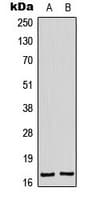BAX Antibody (Internal)