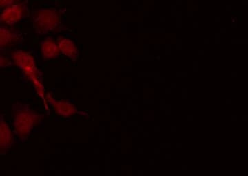 IRF4 Antibody