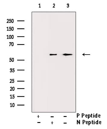 Vitamin D Receptor / VDR Antibody (phospho-Ser208)