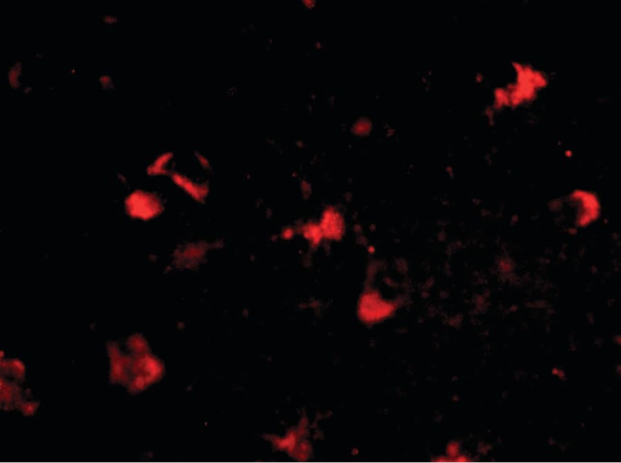 Polyclonal Rabbit anti-Human MEX3A Antibody (IHC, IF, WB)