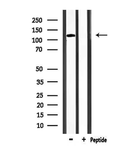 TRPM8 Antibody
