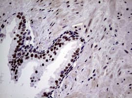 NBN / Nibrin Antibody (clone OTI6H7)