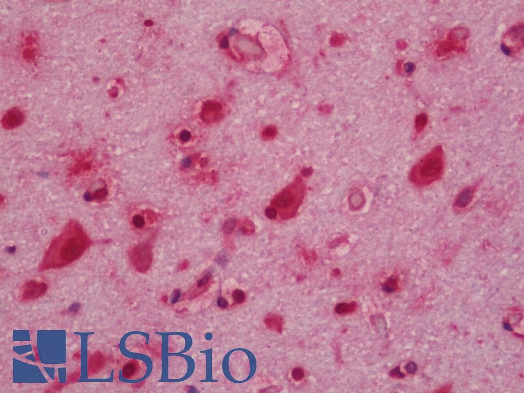 IHC-plus™ BF1 / FOXG1 Antibody (clone 4E11)