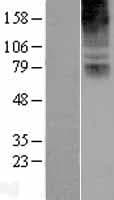 Human COL8A2 / Collagen VIII Protein (Over-Expression Lysate Myc-DDK (Flag))