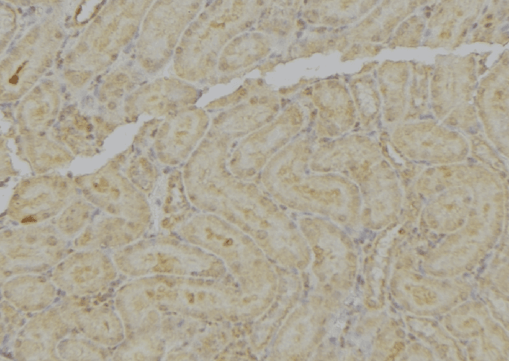 Polyclonal Rabbit anti-Human MT-ND4L Antibody (IHC, WB)