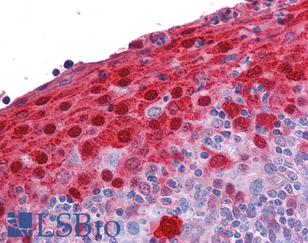 IHC-plus™ S100A7 / Psoriasin Antibody (aa18-30)