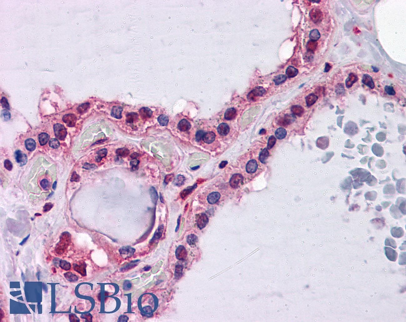 IHC-plus™ Monoclonal Mouse anti-Human HAMP / Hepcidin Antibody (clone 1F9, IHC, WB)