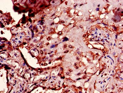 PTMA / Prothymosin Alpha Antibody