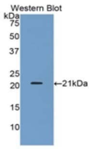 CTSL / Cathepsin L Antibody (aa114-288, APC)