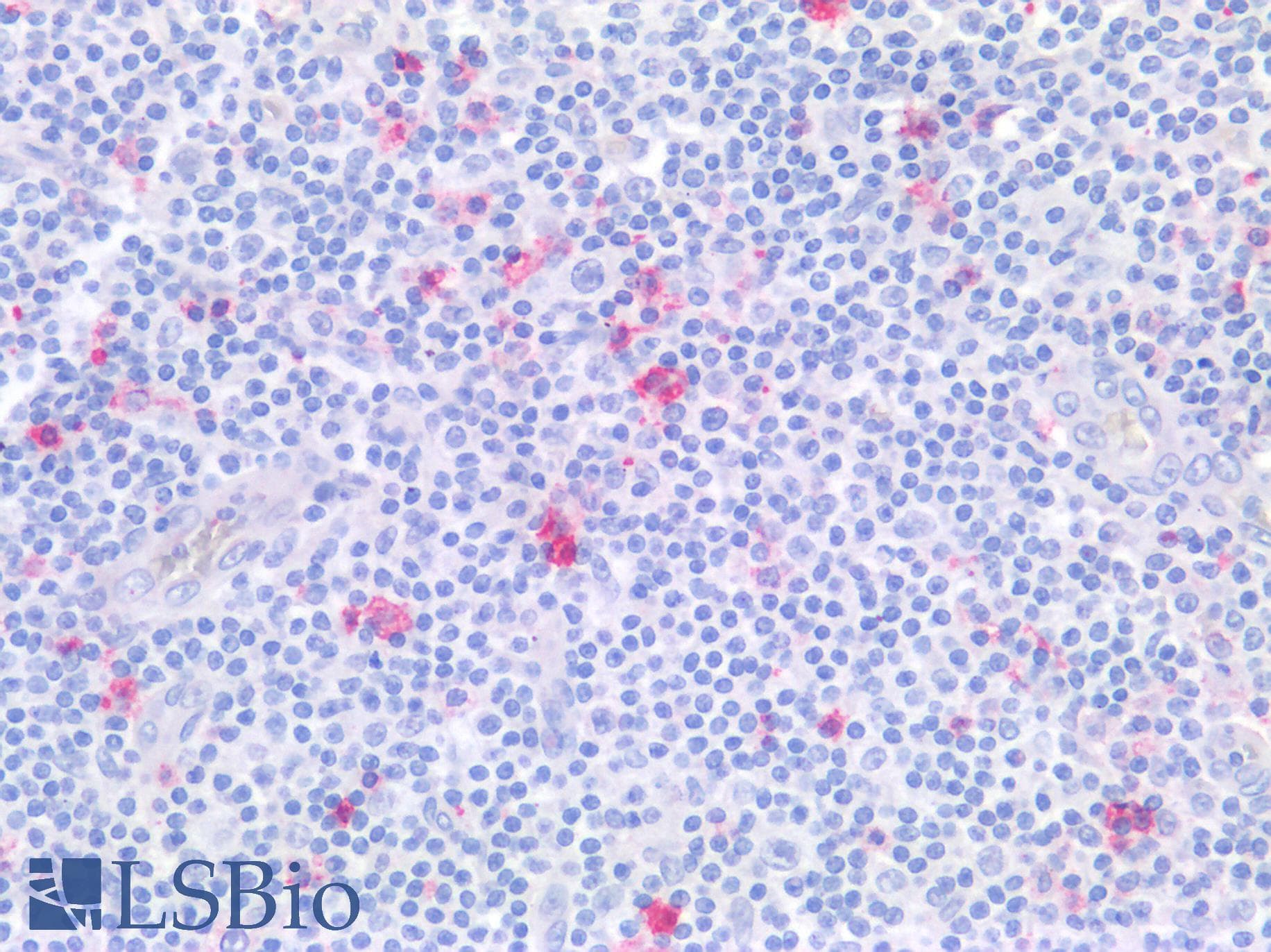 PathPlus™ Monoclonal Mouse anti-Human LAG3 Antibody (clone 9F9, IHC, IF)