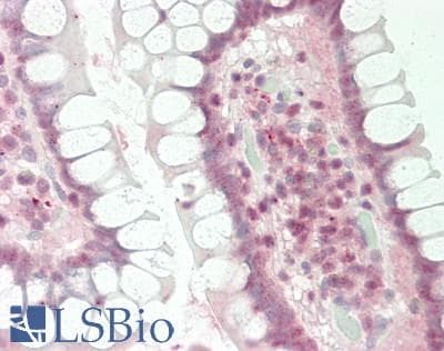 IHC-plus™ Polyclonal Rabbit anti-Human DDIT3 / CHOP Antibody (IHC, IF, WB)
