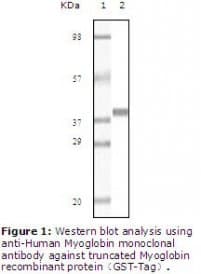 Monoclonal Mouse anti-Human MB / Myoglobin Antibody (clone 6H8B5, 5A2G8, 4D7H3, 3H6A7, IHC, WB)