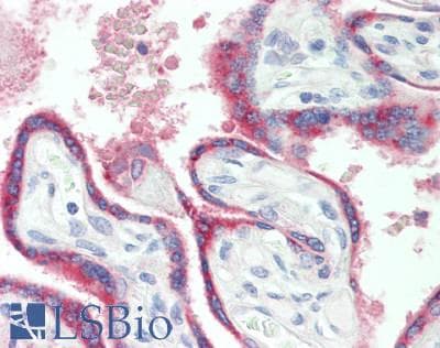 PAPPA / PAPP-A Antibody (aa999-1272)