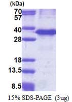Human CTSZ / Cathepsin Z Protein (Recombinant His)