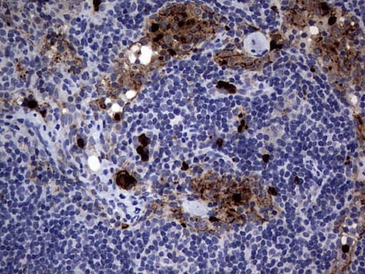 Monoclonal Mouse anti-Human CEACAM5 / CD66e Antibody (clone OTI5F2, aa35-680, IHC, WB)