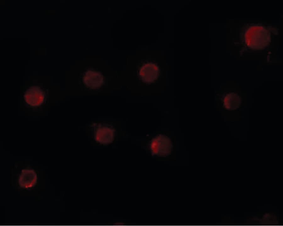 IHC-plus™ ZMYM2 / RAMP Antibody