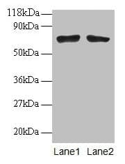 Polyclonal Rabbit anti-Human BMI1 / PCGF4 Antibody (IHC, WB)