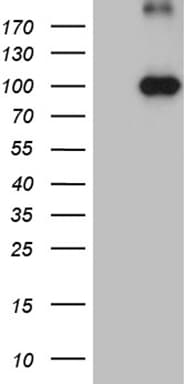 Monoclonal Mouse anti-Human KIF6 Antibody (clone OTI5G2, Carrier-free, aa1-350, IHC, WB)