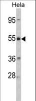 CRHR2 / CRF2 Receptor Antibody (aa243-272)