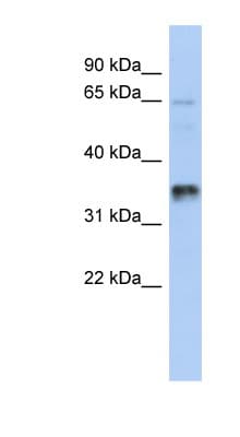 UBAC2 Antibody (aa107-156)