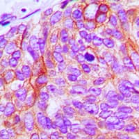 Polyclonal Rabbit anti-Human EGFR Antibody (C-Terminus, IHC, WB)