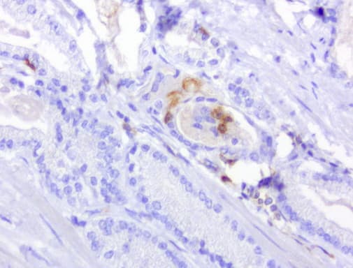 Monoclonal Mouse anti-Human PDCD1 / CD279 / PD-1 Antibody (clone UMAB199, IHC, IF, WB)