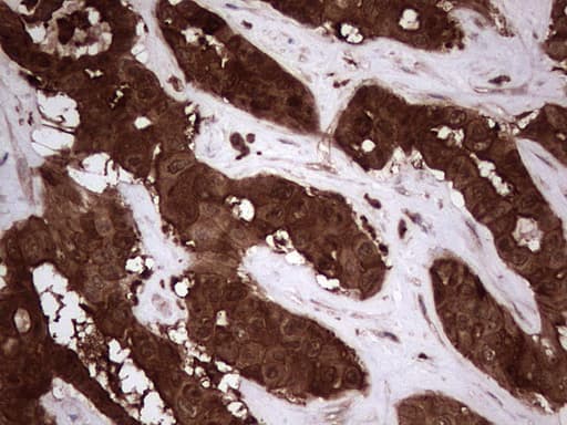 LGALS3 / Galectin 3 Antibody (clone OTI7G9)