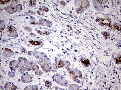 MMP7 / Matrilysin Antibody (aa95-267, clone UMAB168)