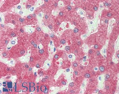 IHC-plus™ Polyclonal Rabbit anti-Human BAG3 / BAG-3 Antibody (aa300-350, IHC, WB)