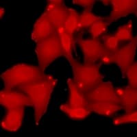 RBX1 / ROC1 Antibody