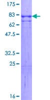 Human INA / Alpha Internexin Protein (Recombinant GST)