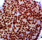 CDC73 / Parafibromin Antibody