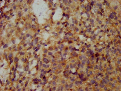 WFDC2 / HE4 Antibody
