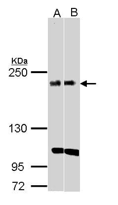 IHC-plus™ Polyclonal Rabbit anti-Human KIDINS220 / ARMS Antibody (aa1706-1771, IHC, WB)
