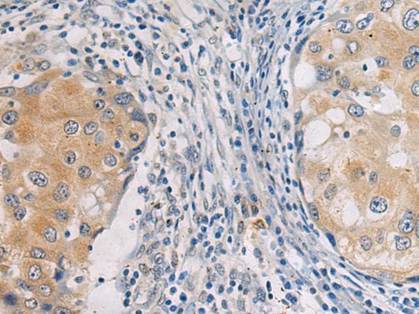 Polyclonal Rabbit anti-Human GBA / Glucosidase Beta Acid Antibody (IHC, WB)
