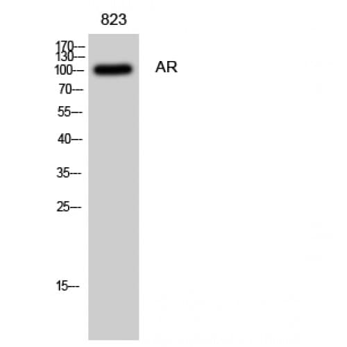 AR / Androgen Receptor Antibody (590-670 aa)