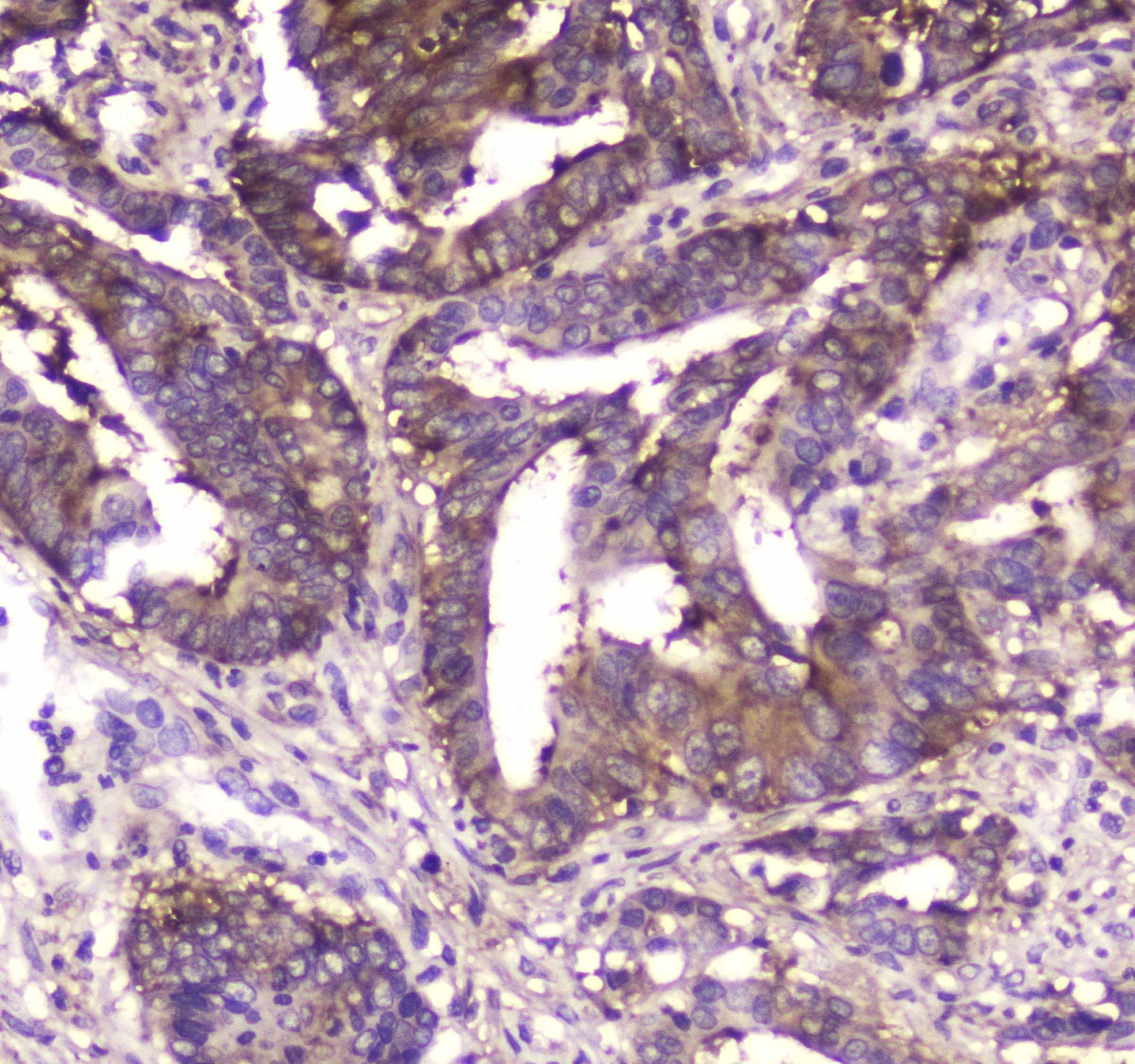 MVP / VAULT1 Antibody