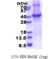 Human CD5 Protein (Recombinant His)