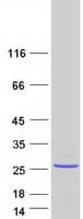 Human FAM180B Protein (Recombinant Myc-DDK (Flag))