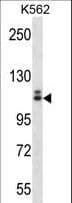 c-Kit / CD117 Antibody (aa912-941)