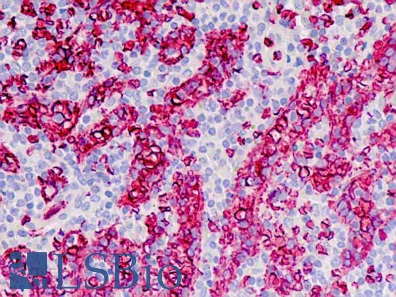 IHC-plus™ Blood Group A Antibody