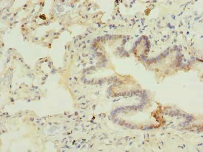 Polyclonal Rabbit anti-Human C7orf61 Antibody (IHC)