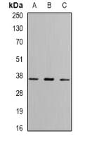 FBP1 Antibody