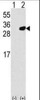 PRDX6 / Peroxiredoxin 6 Antibody (aa197-224)