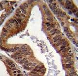 TDP2 / TTRAP Antibody (aa246-272)