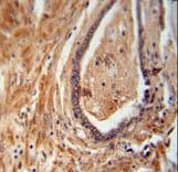 Polyclonal Rabbit anti-Human NDUFAF1 / CIA30 Antibody (aa247-276, IHC, WB)