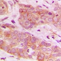 Polyclonal Rabbit anti-Human PRKAB1 / AMPK Beta 1 Antibody (IHC, WB)