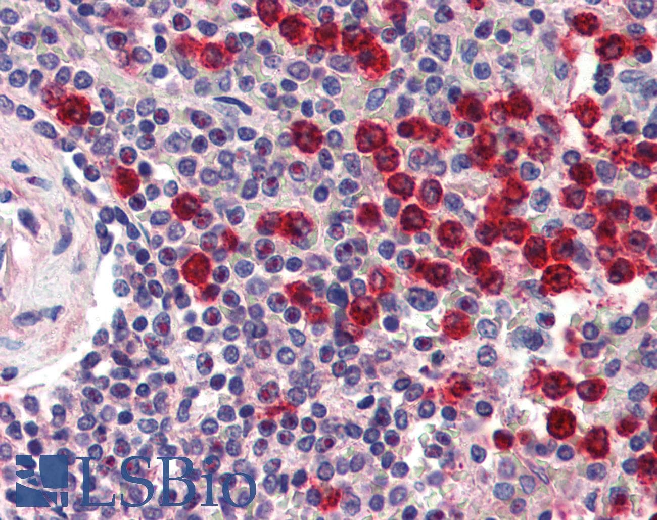 IHC-plus™ MMP9 / Gelatinase B Antibody