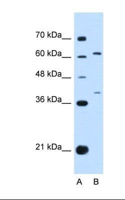 CRF2-12 / IL28RA Antibody (aa51-100)